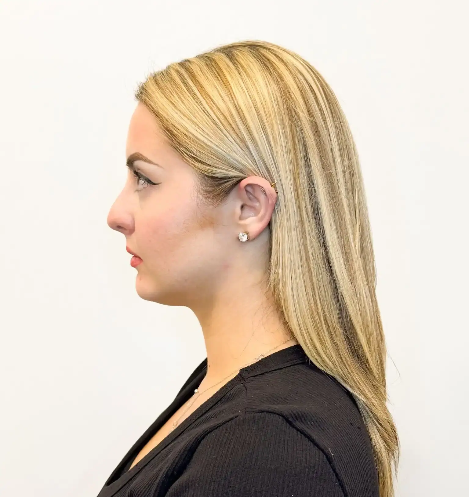 Before treatment — client 1