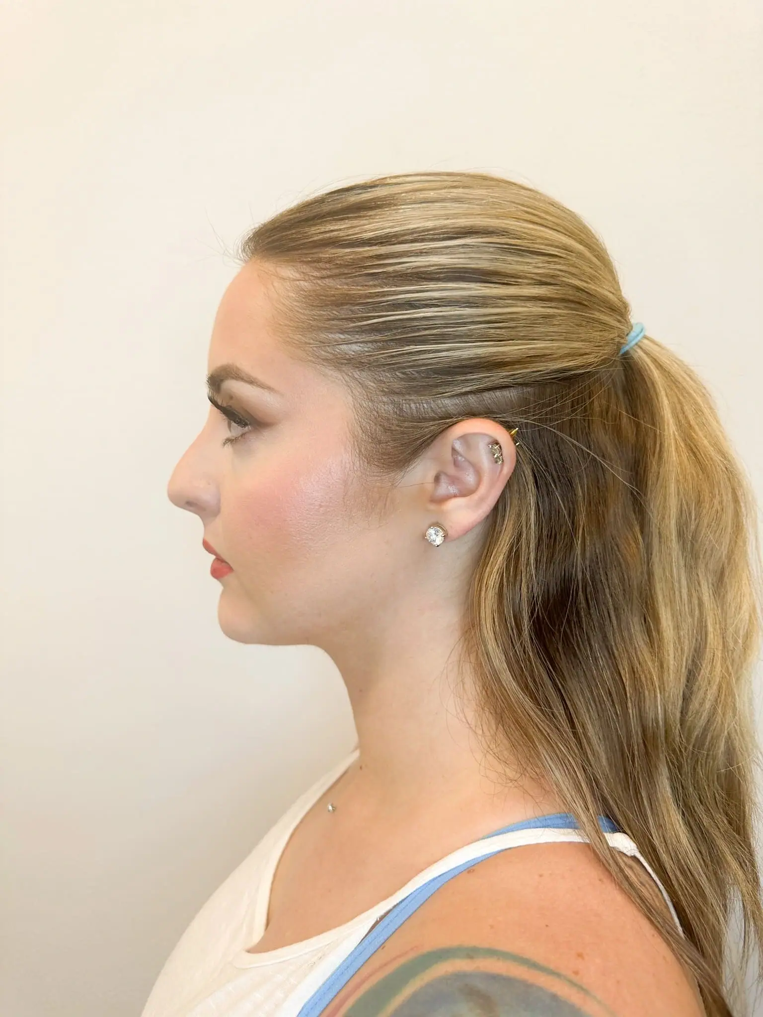 After treatment — client 1