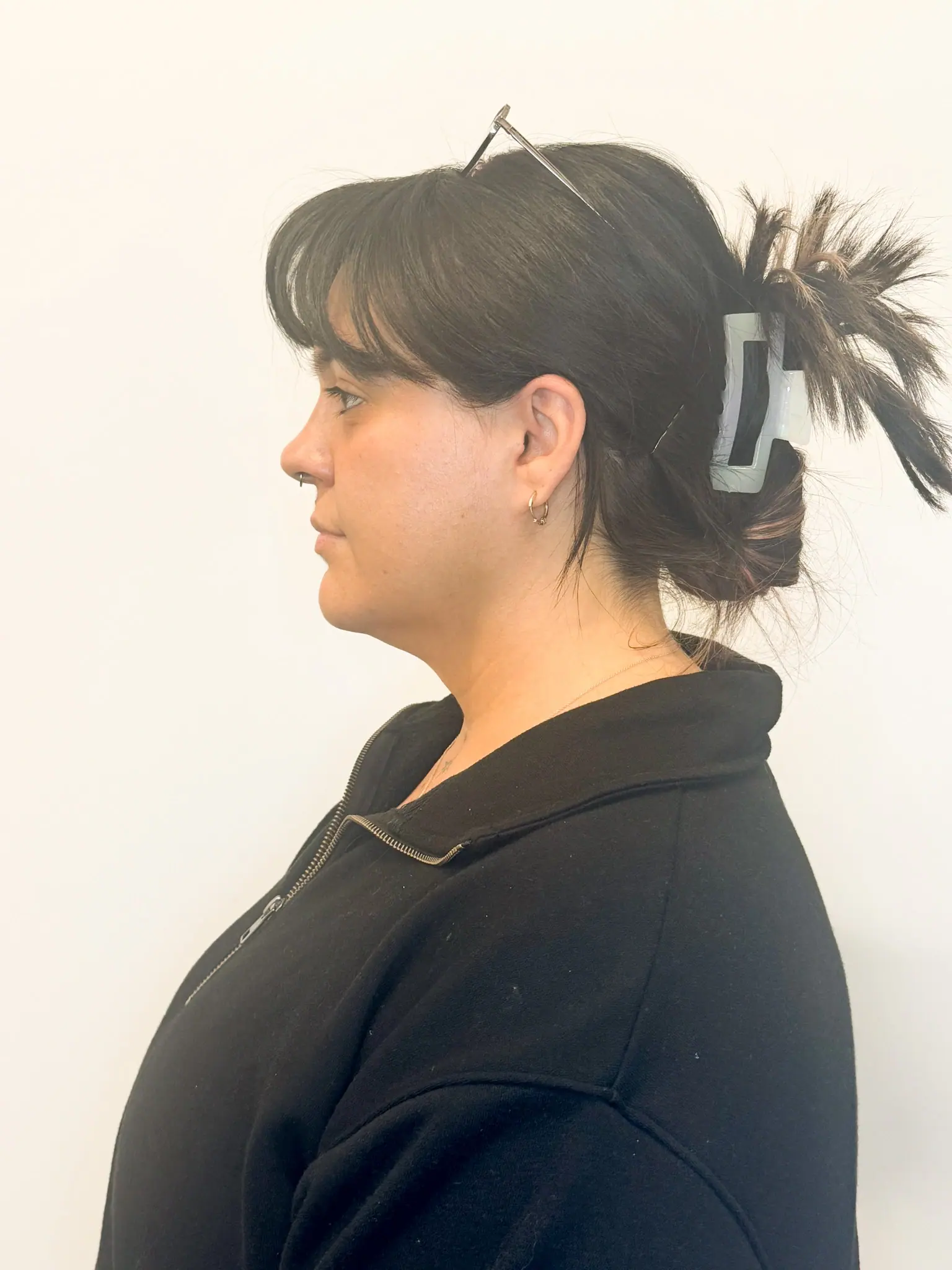 Before treatment — client 2