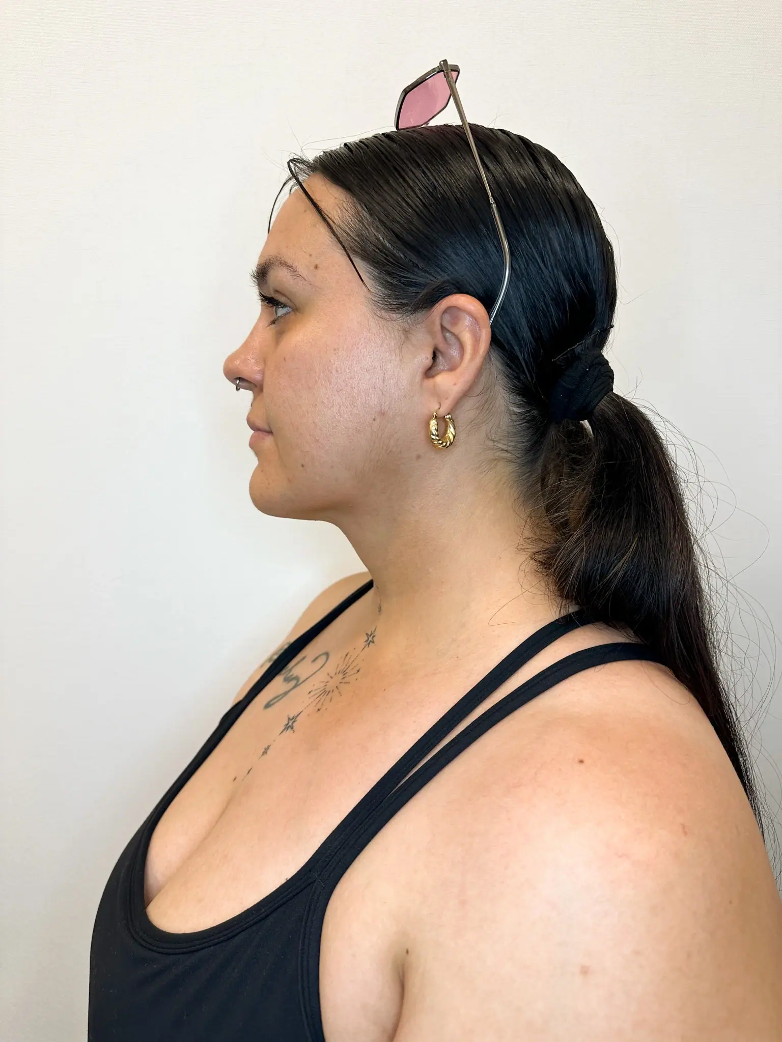 After treatment — client 2