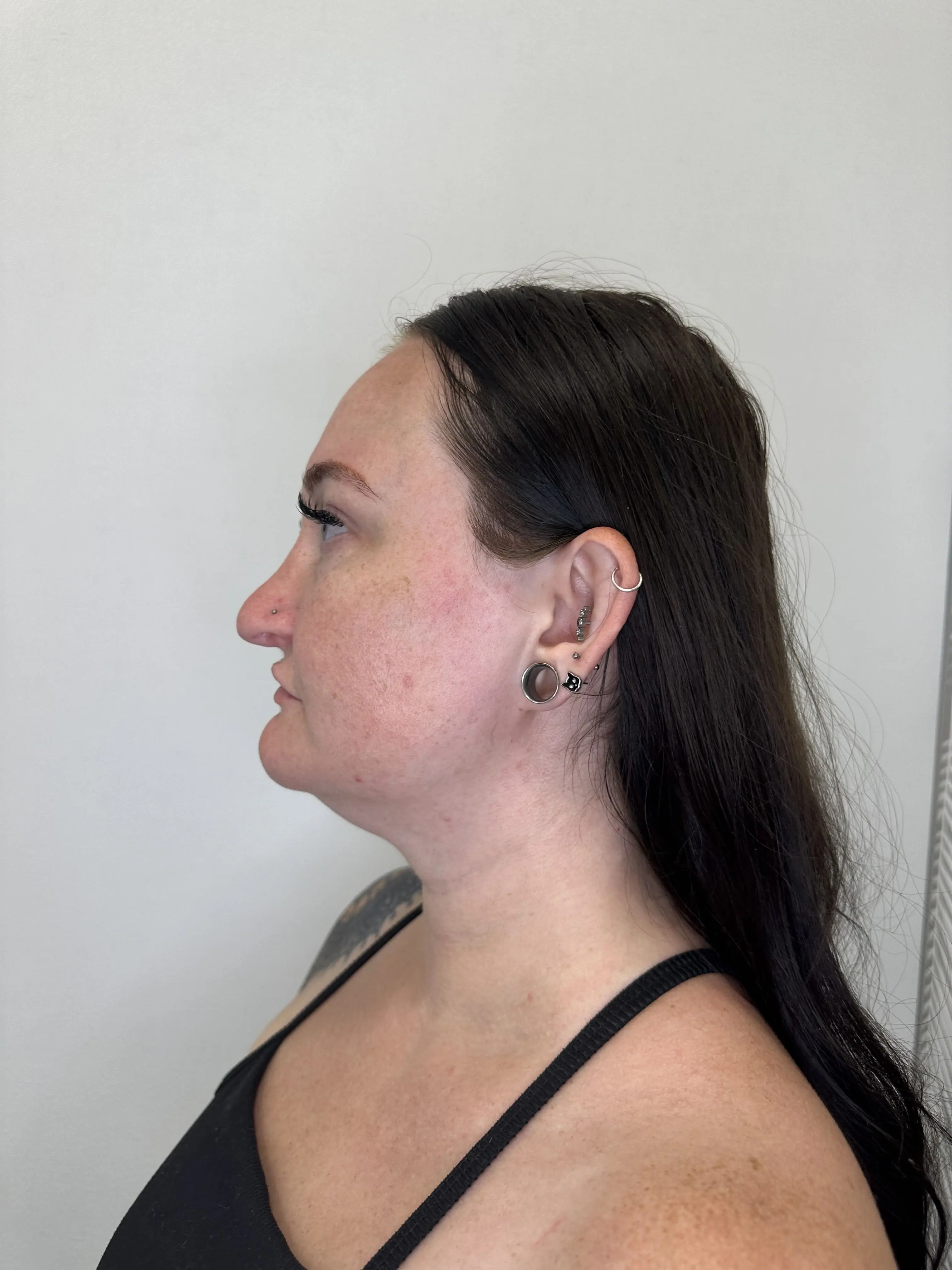 Before treatment — client 3