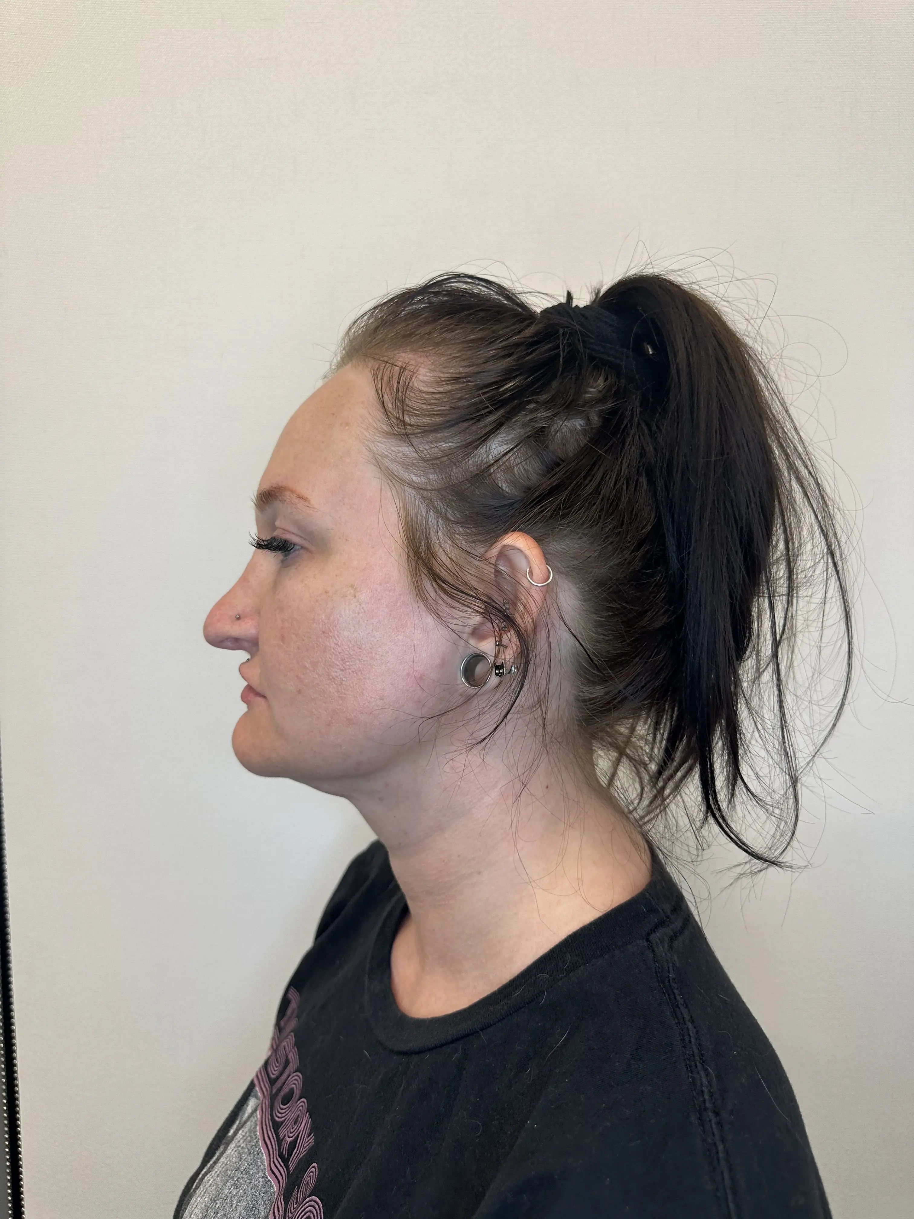 After treatment — client 3