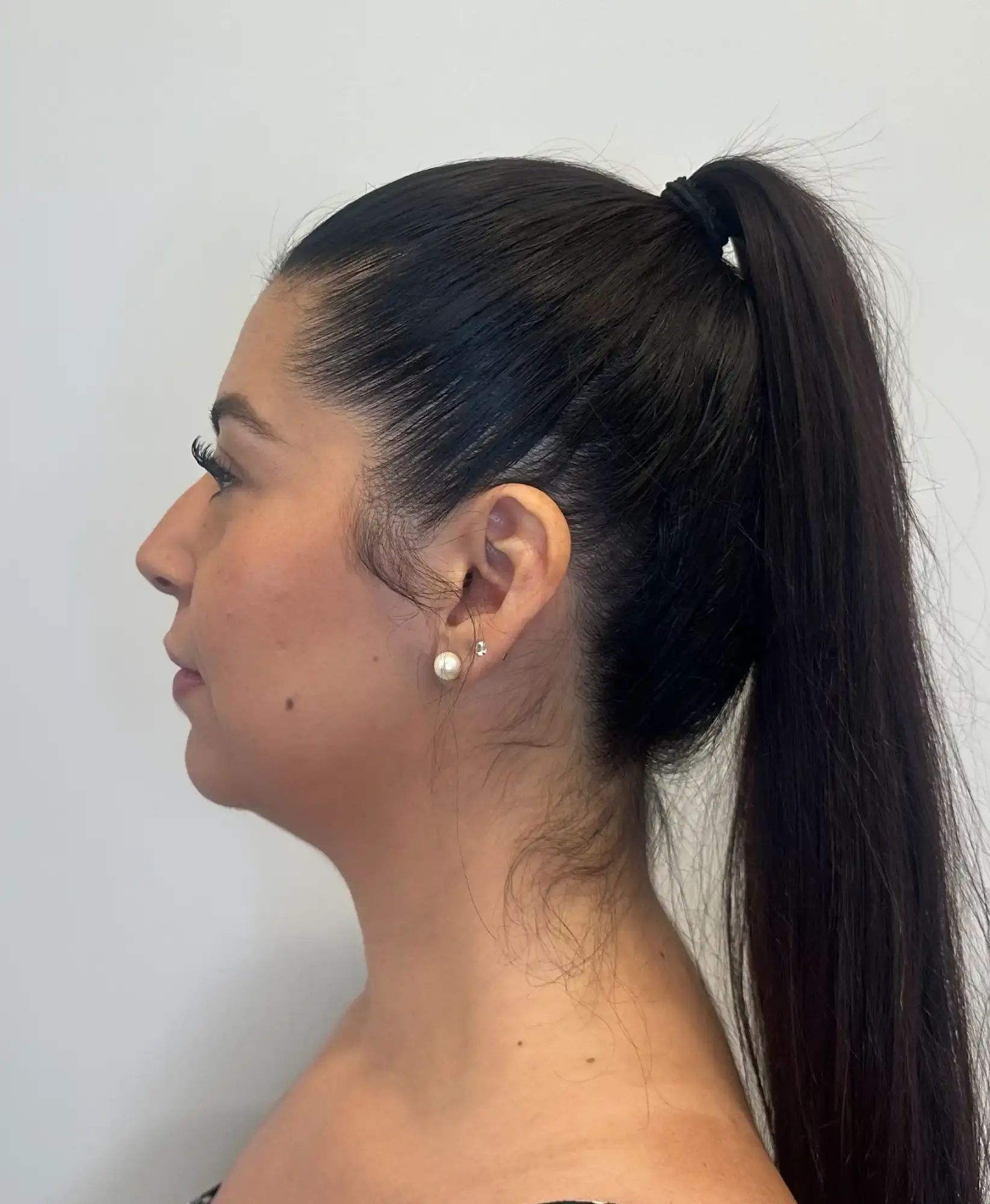 Before treatment — client 5