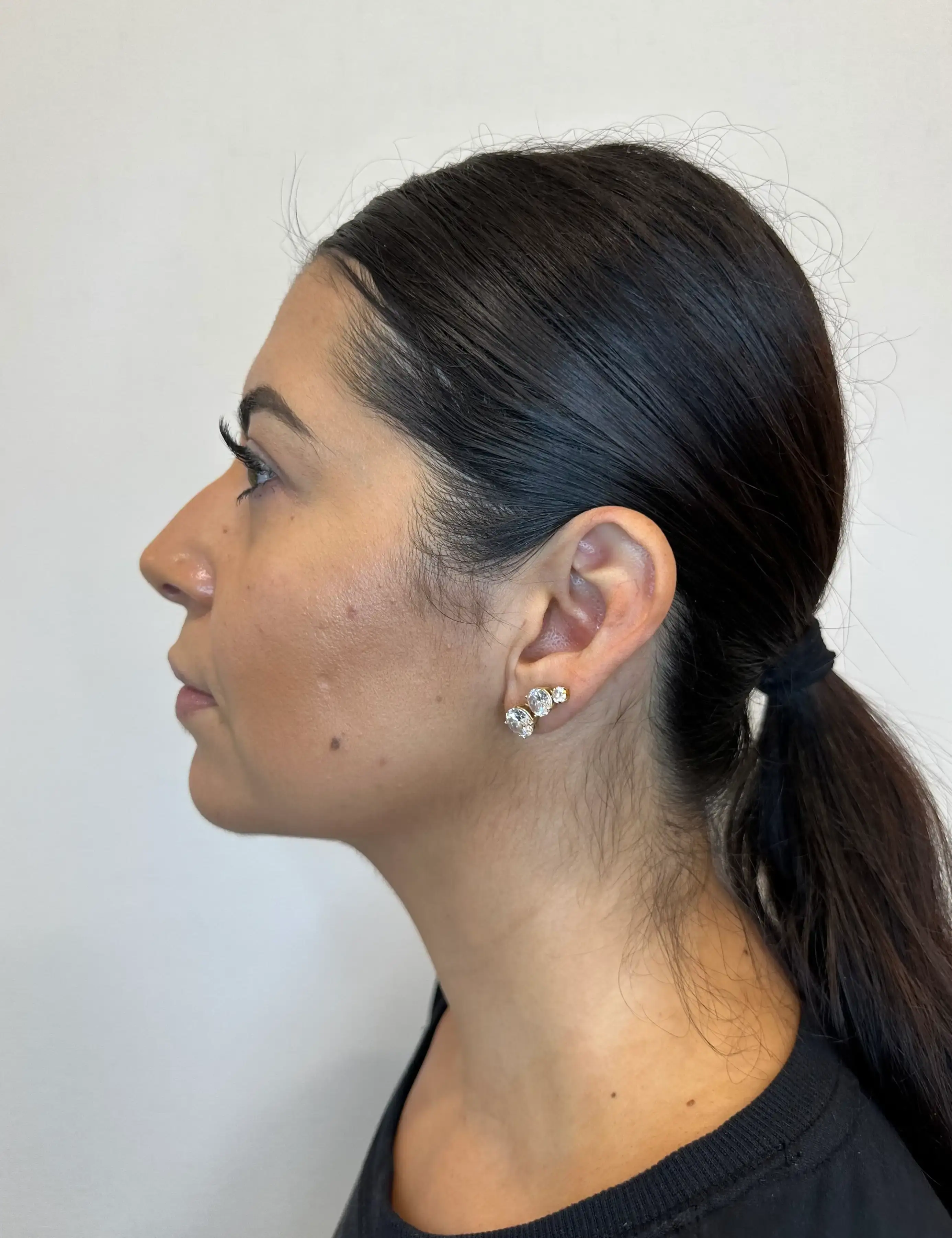 After treatment — client 5