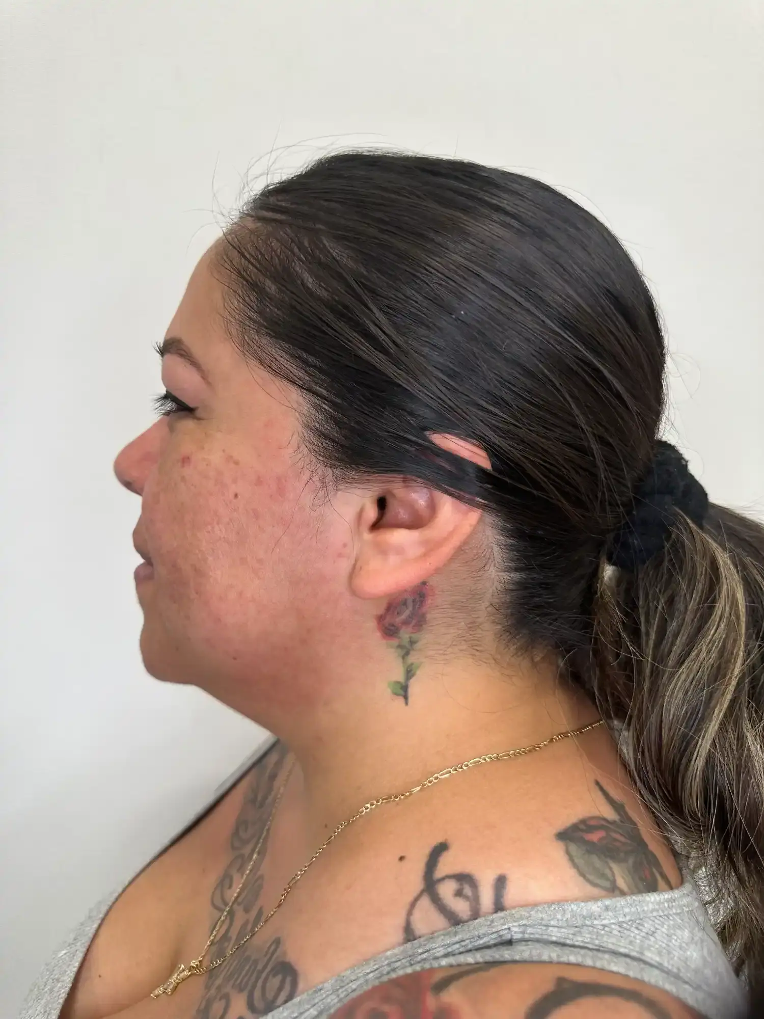 Before treatment — client 6