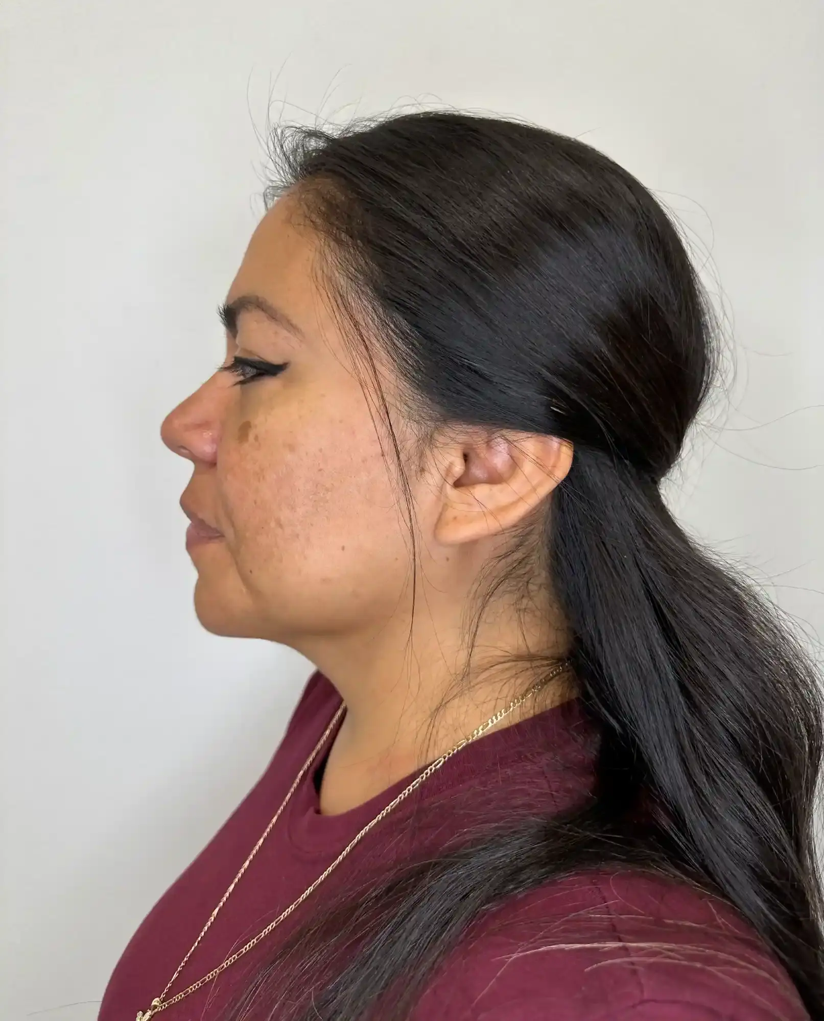 After treatment — client 6